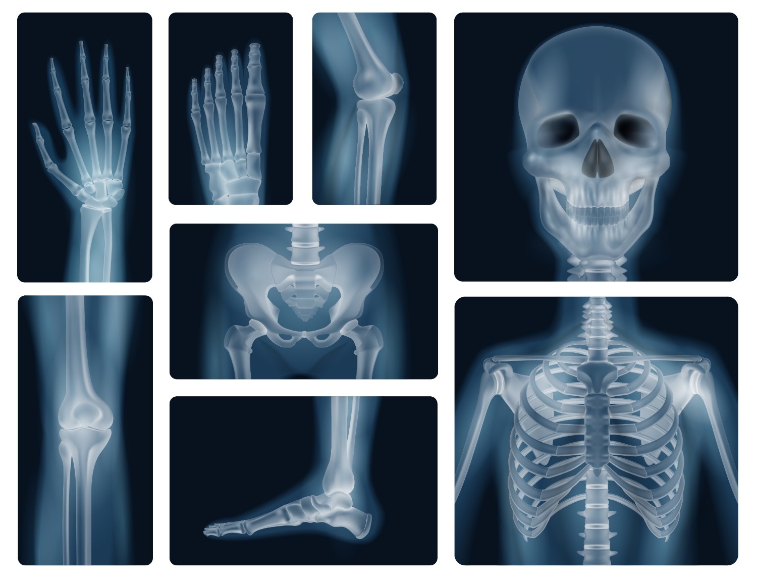 Digital X-Ray